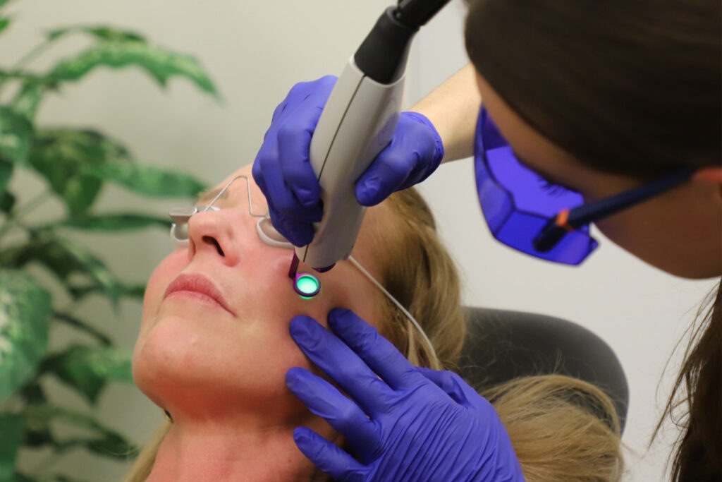 Vbeam Laser in Ottawa: Non-invasive solution to eliminate redness and skin imperfections.